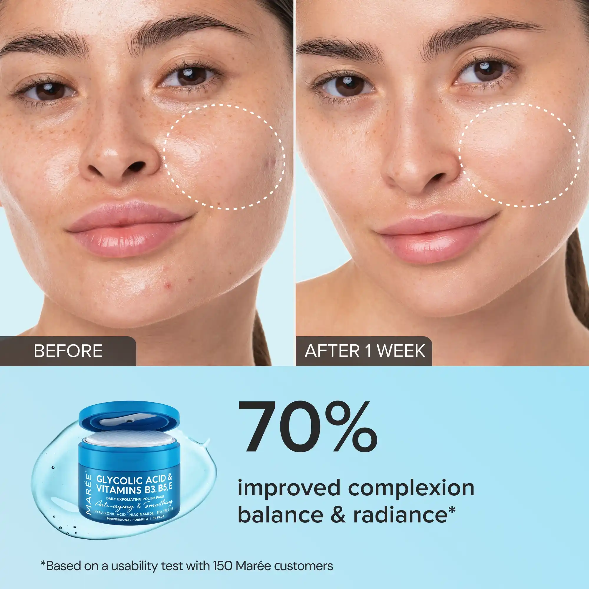 Glycolic Acid Exfoliating Pads