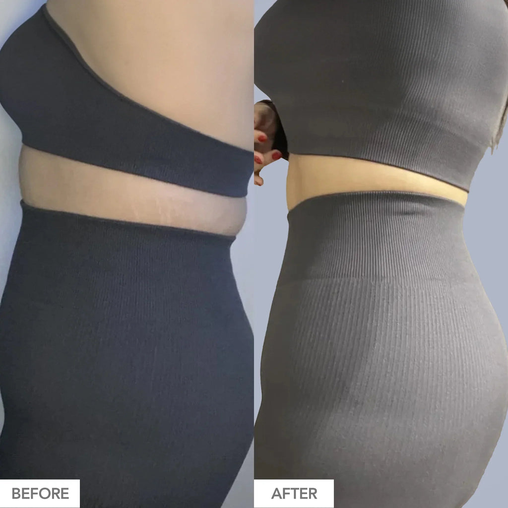 BLOATamin®
